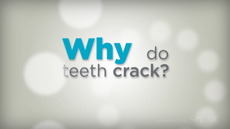 Cracked Teeth (No Instruments)