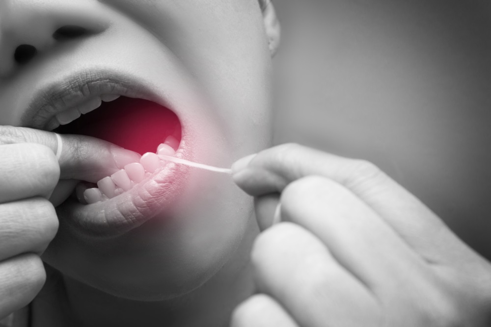 Why we need to pay more attention to gumline cavities