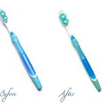 How Do You Know When to Replace Your Toothbrush?