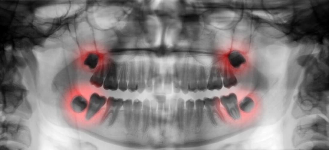 Dental referrals to other specialists: How your mouth can show symptoms of non-oral disease Dental referrals to other specialists: How your mouth can show symptoms of non-oral disease